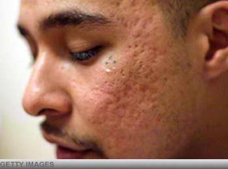 Hình xăm ba chấm tượng trưng cho triết lý sống Mi Vida Loca - Cuộc sống điên cuồng